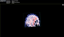 FIGURE 3. A photoacoustic image of vasculature in a mouse ear shows an oxygen saturation map of the vasculature (red = high oxygen saturation, blue = low oxygen saturation). FIGURE 3. A photoacoustic image of vasculature in a mouse ear shows an oxygen saturation map of the vasculature (red = high oxygen saturation, blue = low oxygen saturation).