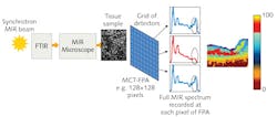 FIGURE 2. Traditional MIR spectral imaging of excised biological tissue involves a benchtop setup comprising a source (MIR blackbody or a synchrotron-generated MIR beam, as depicted here) passed through a FT-MIR spectrometer and onto the tissue sample in a MIR microscope. A MCT-FPA detector captures spectral images and records a full spectrum at each pixel. The acquired spectral sets are treated statistically to yield molecular discrimination across the MIR tissue image shown as a false color map. The false color map is obtained by establishing similarities in spectral patterns (mathematically), then grouping spectra accordingly, and finally assigning color codes to form an objective map-free from subjective assignment. FIGURE 2. Traditional MIR spectral imaging of excised biological tissue involves a benchtop setup comprising a source (MIR blackbody or a synchrotron-generated MIR beam, as depicted here) passed through a FT-MIR spectrometer and onto the tissue sample in a MIR microscope. A MCT-FPA detector captures spectral images and records a full spectrum at each pixel. The acquired spectral sets are treated statistically to yield molecular discrimination across the MIR tissue image shown as a false color map. The false color map is obtained by establishing similarities in spectral patterns (mathematically), then grouping spectra accordingly, and finally assigning color codes to form an objective map-free from subjective assignment.