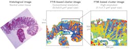 FIGURE 3. State-of-the-art MIR spectral images of excised normal colon tissue (right) provide more information than does a conventional histopathological micrograph of the H&E-stained colon tissue (left). FIGURE 3. State-of-the-art MIR spectral images of excised normal colon tissue (right) provide more information than does a conventional histopathological micrograph of the H&E-stained colon tissue (left).