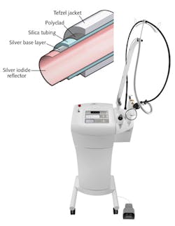 FIGURE 1. A new high-transmission hollow waveguide design intended for use with carbon dioxide (CO2) surgical lasers consists of a glass tube coated on its inner surface with silver and silver iodide (AgI) films, and on its outside with a protective cladding and jacket. When coupled to a CO2 laser, the fiber serves as a flexible light-delivery tool for surgeons. FIGURE 1. A new high-transmission hollow waveguide design intended for use with carbon dioxide (CO2) surgical lasers consists of a glass tube coated on its inner surface with silver and silver iodide (AgI) films, and on its outside with a protective cladding and jacket. When coupled to a CO2 laser, the fiber serves as a flexible light-delivery tool for surgeons.