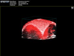 FIGURE 1. A photoacoustic image of melanin expressed under the tyrosinase reporter in a subcutaneous tumor. FIGURE 1. A photoacoustic image of melanin expressed under the tyrosinase reporter in a subcutaneous tumor.