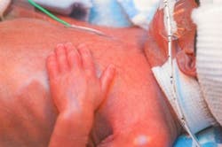 3384991 Premature Baby Resting Web 3384991 Premature Baby Resting Web