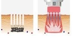 Content Dam Bow Online Articles 2016 03 Fractat Thumb Content Dam Bow Online Articles 2016 03 Fractat Thumb