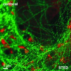 Content Dam Bow Online Articles 2016 03 Pattern Matching Confcoal Sted Web Content Dam Bow Online Articles 2016 03 Pattern Matching Confcoal Sted Web