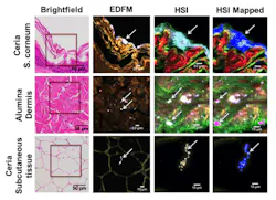 Porcine skin tissue exposed to engineered nano material (ENM)-containing solution is mapped against the reference spectral library (RSL).Rows correspond to porcine skin tissue exposed to ceria and alumina ENMs, respectively. Each column shows the same field of view imaged with different techniques. The first column corresponds to a brightfield image of a hematoxylin and eosin stained sample (40X magnification). The area enclosed in a red square was magnified to 100X and viewed using EDFM (column 2) and HSI (column 3), where ENMs appear as high contrast elements (arrows). Column 4 shows the HSI image mapped against the RSL, where the positive matches are shown in blue for ceria and in magenta for alumina. From top to bottom, the rows correspond to: stratum corneum, dermis, and subcutaneous tissue, respectively.