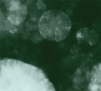FIGURE 3. Quenched droplets of melted diamond were produced by focused Q-switched Nd:YAG laser heating of particles of diamond suspended in NaCl at pressure in the stability field of diamond. High-resolution electron micrographs (not shown) indicated a giant fullerene type layering surrounding polycrystalline interiors. The nearly perfect circular droplet in the upper portion of the image is 0.25 &mu;m in diameter.
