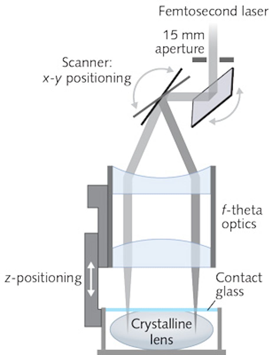 The 3D scanning unit used for femtosecond-lentotomy in the IKARUS project includes two galvanometer scanning mirrors and a linear translation stage that moves the fixation unit of the crystalline lens relative to the focusing lens. f-theta focusing optics (f = 75 mm) provide spatial positioning at