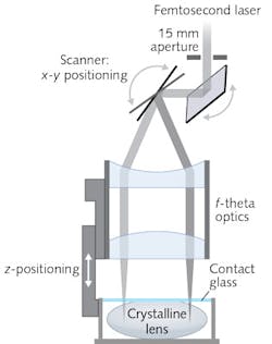 The 3D scanning unit used for femtosecond-lentotomy in the IKARUS project includes two galvanometer scanning mirrors and a linear translation stage that moves the fixation unit of the crystalline lens relative to the focusing lens. f-theta focusing optics (f = 75 mm) provide spatial positioning at The 3D scanning unit used for femtosecond-lentotomy in the IKARUS project includes two galvanometer scanning mirrors and a linear translation stage that moves the fixation unit of the crystalline lens relative to the focusing lens. f-theta focusing optics (f = 75 mm) provide spatial positioning at