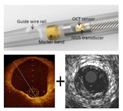 Content Dam Bow Online Articles 2016 05 Dual Oct Ivus Catheter Content Dam Bow Online Articles 2016 05 Dual Oct Ivus Catheter