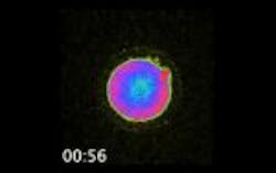 Content Dam Bow Online Articles 2016 05 Ivf Thumb Content Dam Bow Online Articles 2016 05 Ivf Thumb