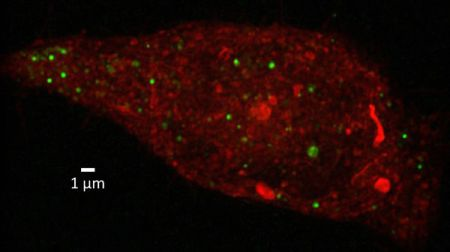 Content Dam Bow Online Articles 2016 05 Medimmune Exosomes Web