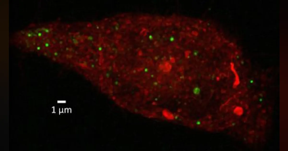 Resolution Microbe Super-resolution microscopy could find utility in therapeutic drug ...