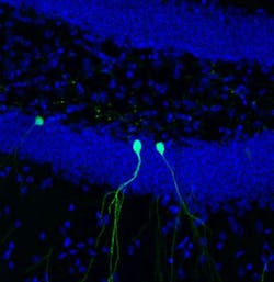 Content Dam Bow Online Articles 2016 05 Newborn Neurons Rv Gfp 40x 2013 Web Content Dam Bow Online Articles 2016 05 Newborn Neurons Rv Gfp 40x 2013 Web