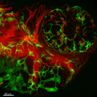 Content Dam Bow En Articles 2016 06 Confocal Imaging Platform By Andor Technology Leftcolumn Article Thumbnailimage File