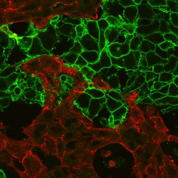 Content Dam Bow Online Articles 2016 06 Celldelivery Immuno 460w Web