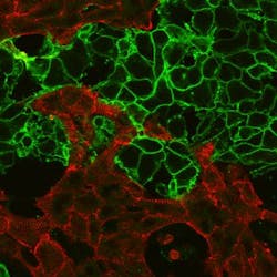 Content Dam Bow Online Articles 2016 06 Celldelivery Immuno 460w Web Content Dam Bow Online Articles 2016 06 Celldelivery Immuno 460w Web