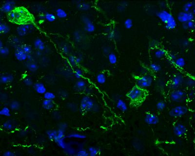 Content Dam Bow Online Articles 2016 06 Uab Tac2 Web