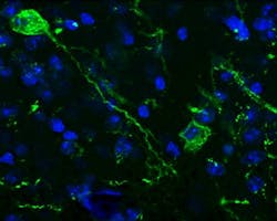 Content Dam Bow Online Articles 2016 06 Uab Tac2 Web Content Dam Bow Online Articles 2016 06 Uab Tac2 Web