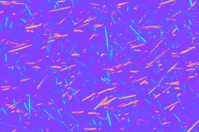 Content Dam Bow Online Articles 2016 07 Uric Acid Crystals Mid Web