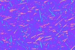 Content Dam Bow Online Articles 2016 07 Uric Acid Crystals Mid Web Content Dam Bow Online Articles 2016 07 Uric Acid Crystals Mid Web