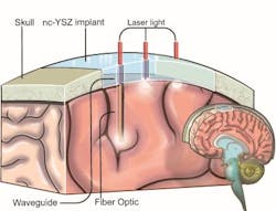 Content Dam Bow Online Articles 2016 07 Window To The Brain Web Content Dam Bow Online Articles 2016 07 Window To The Brain Web