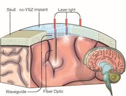 Content Dam Bow Online Articles 2016 07 Window To The Brain Web Content Dam Bow Online Articles 2016 07 Window To The Brain Web