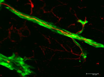 Content Dam Bow En Articles 2016 08 Fluorescence Microscopy Helps Provide New Insight Into How Cancer Cells Metastasize Leftcolumn Article Thumbnailimage File