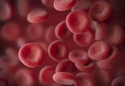 Content Dam Bow Online Articles 2016 08 Bloodbags Web Content Dam Bow Online Articles 2016 08 Bloodbags Web