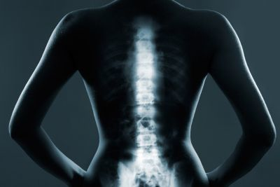 Content Dam Bow Online Articles 2016 08 Mit Epidural Placement Web