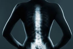 Content Dam Bow Online Articles 2016 08 Mit Epidural Placement Web Content Dam Bow Online Articles 2016 08 Mit Epidural Placement Web