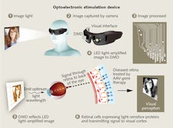 GenSight Biologics is augmenting its genetic approach to retinitis pigmentosa therapy with goggles including a video camera, a digital micromirror array (DMD), and an LED light source. GenSight Biologics is augmenting its genetic approach to retinitis pigmentosa therapy with goggles including a video camera, a digital micromirror array (DMD), and an LED light source.