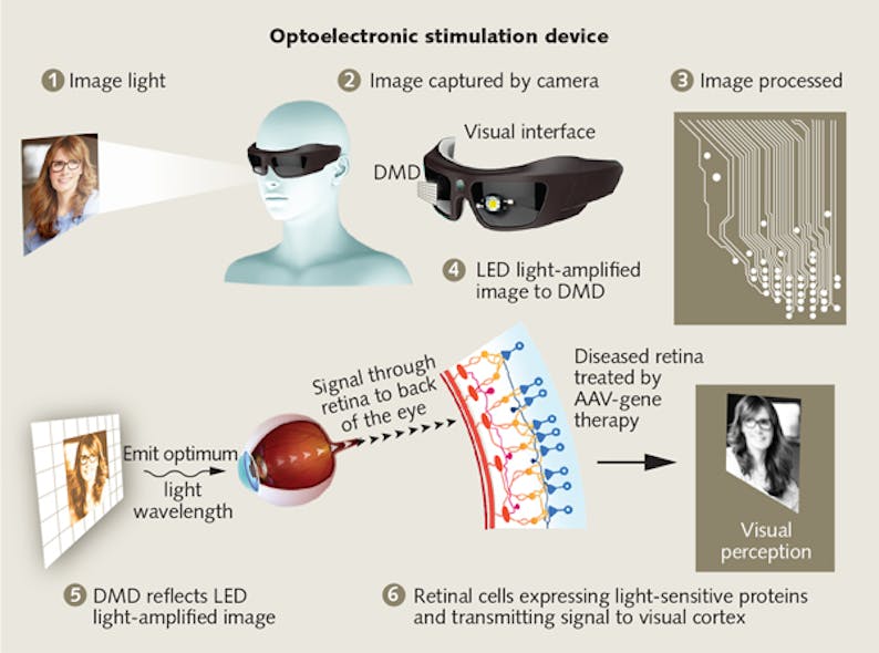GenSight Biologics is augmenting its genetic approach to retinitis pigmentosa therapy with goggles including a video camera, a digital micromirror array (DMD), and an LED light source.