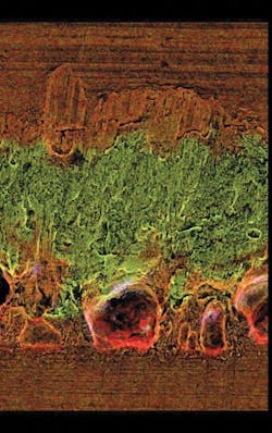 FIGURE 4. A scanning electron microscope image showing a 302 stainless-steel-to-phosphor-bronze weld at 600X magnification. FIGURE 4. A scanning electron microscope image showing a 302 stainless-steel-to-phosphor-bronze weld at 600X magnification.
