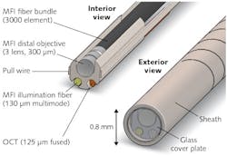 Less than a millimeter in diameter, the latest version of the falloposcope incorporates separate illumination fibers for OCT and multispectral fluorescence imaging (MFI; 125 μm single-mode and 130 μm multimode, respectively); a three-lens, 300 μm distal objective for MFI; a bundle of 3000-element optical fiber for imaging; and two pull wires to enable steering of the imaging element during the assessment procedure. Less than a millimeter in diameter, the latest version of the falloposcope incorporates separate illumination fibers for OCT and multispectral fluorescence imaging (MFI; 125 μm single-mode and 130 μm multimode, respectively); a three-lens, 300 μm distal objective for MFI; a bundle of 3000-element optical fiber for imaging; and two pull wires to enable steering of the imaging element during the assessment procedure.