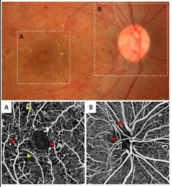 Picture1 Web Picture1 Web