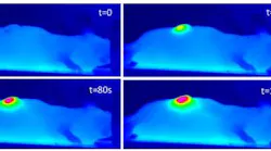 Content Dam Bow Online Articles 2017 01 Nanohyperthermie Web