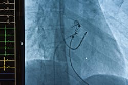 Content Dam Ils Print Articles 2017 1 1701ils Upd 3 Content Dam Ils Print Articles 2017 1 1701ils Upd 3