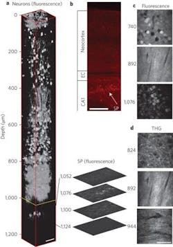 FIGURE 2. BiOS 2017 will feature a second major plenary, titled Neurotechnologies, which correlates with SPIE's new Brain virtual application track. Among the ten presenters will be Chris Xu (Cornell University) speaking on three-photon microscopy for deep brain imaging. Xu’s lab created this 3D depiction of a mouse brain from microphotographs made with a three-photon system. FIGURE 2. BiOS 2017 will feature a second major plenary, titled Neurotechnologies, which correlates with SPIE's new Brain virtual application track. Among the ten presenters will be Chris Xu (Cornell University) speaking on three-photon microscopy for deep brain imaging. Xu’s lab created this 3D depiction of a mouse brain from microphotographs made with a three-photon system.