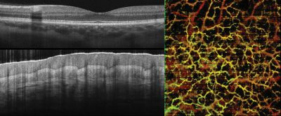 Content Dam Bow Online Articles 2017 02 3 Upcobra S Images 3