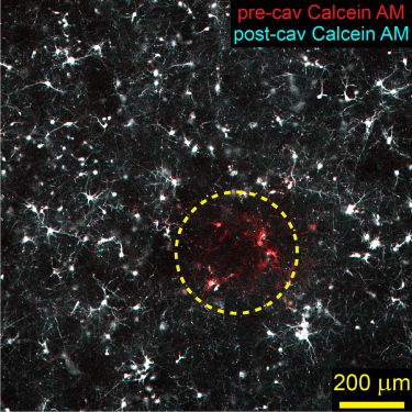 Content Dam Bow Online Articles 2017 02 Bps Estrada Confocal Image Neurons Web