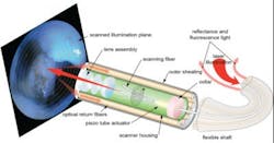 Content Dam Bow Online Articles 2017 02 Endoscope Web Content Dam Bow Online Articles 2017 02 Endoscope Web