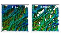 Content Dam Bow Online Articles 2017 02 Web2017 012 Hoechstaufloesende Lichtmikroskopie Ohne Content Dam Bow Online Articles 2017 02 Web2017 012 Hoechstaufloesende Lichtmikroskopie Ohne