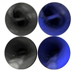 Endoscope Image 1 Web Endoscope Image 1 Web