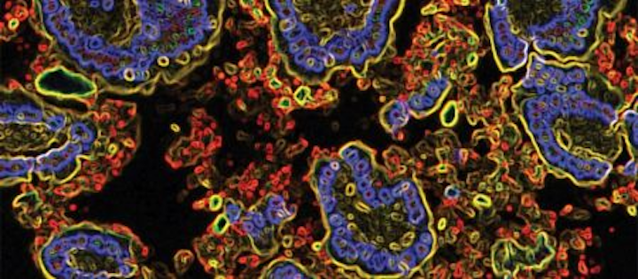 Flow Cytometry Discovers Bacteria That Links Crohn S Disease To Joint Pain Laser Focus World