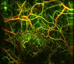 Content Dam Bow Online Articles 2017 03 Msot Tumor Web Content Dam Bow Online Articles 2017 03 Msot Tumor Web