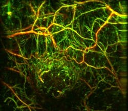 Content Dam Bow Online Articles 2017 03 Msot Tumor Web Content Dam Bow Online Articles 2017 03 Msot Tumor Web