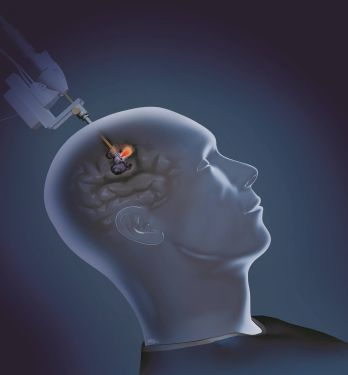 Content Dam Bow Online Articles 2017 04 Monteris Web