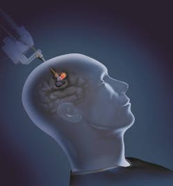 Content Dam Bow Online Articles 2017 04 Monteris Web Content Dam Bow Online Articles 2017 04 Monteris Web