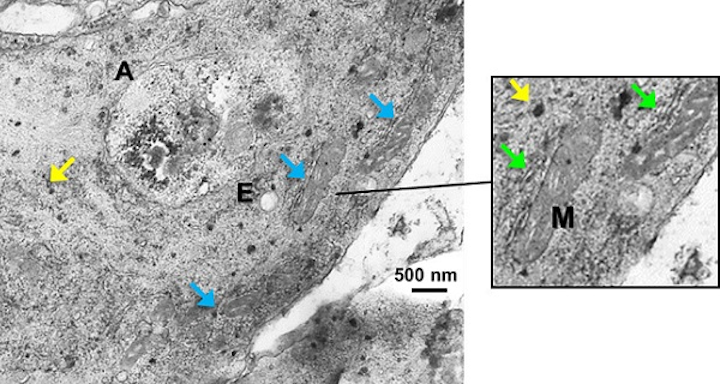 A transmission-electron-microscope image shows A549 cells incubated with AuNPs and single-walled carbon nanotubes at a concentration of 0.25mg/ml; yellow arrows point to AuNPs, blue arrows to mitochondria (M), and green arrows to endoplasmic reticulum. (Image credit: SPIE)