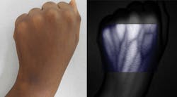 FIGURE 4. An OEM implementation enables improved visualization of vascular details (inset). FIGURE 4. An OEM implementation enables improved visualization of vascular details (inset).